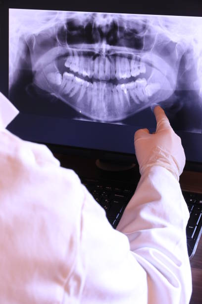 Best Dentist for Tooth Abscess  in Mill Hall, PA
