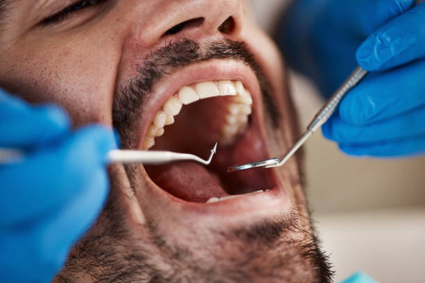 Best Dentist for Severe Toothache  in Mill Hall, PA
